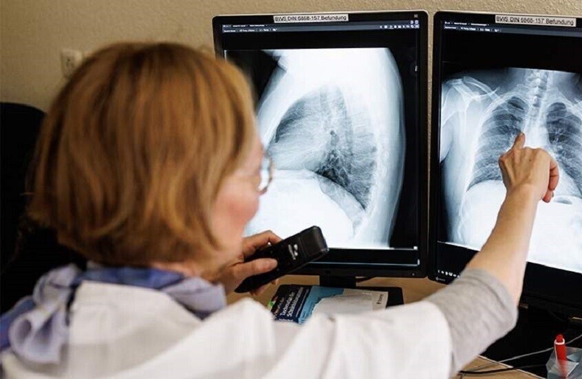 روسيا.. بكتيريا جديدة تساعد على علاج مرض السل المقاوم للأدوية