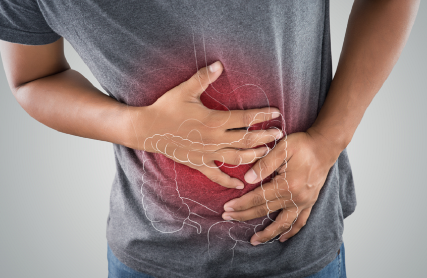 سبب خفي وغامض لأعراض معوية مزعجة تصيب الملايين