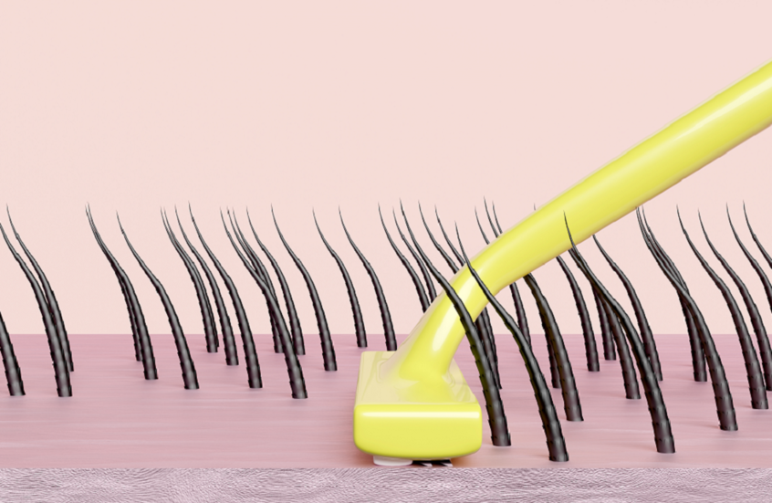 وداعا للشمع والشفرات.. طريقة جديدة لإزالة الشعر غير المرغوب فيه!