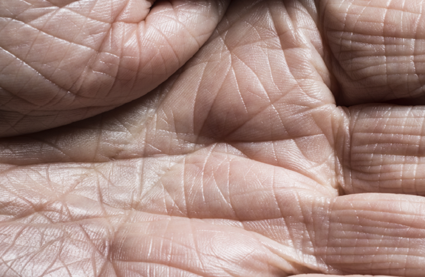 لأول مرة.. اكتشاف "صرخة" الجلد الصامتة لدى البشر