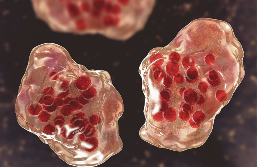 "أشد الأمراض المعدية" يصل إلى واشنطن!