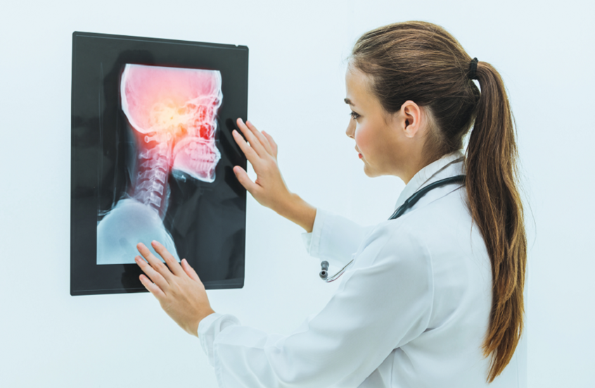 اكتشاف جديد يفسر علاقة التدخين بسرطان الرأس والرقبة