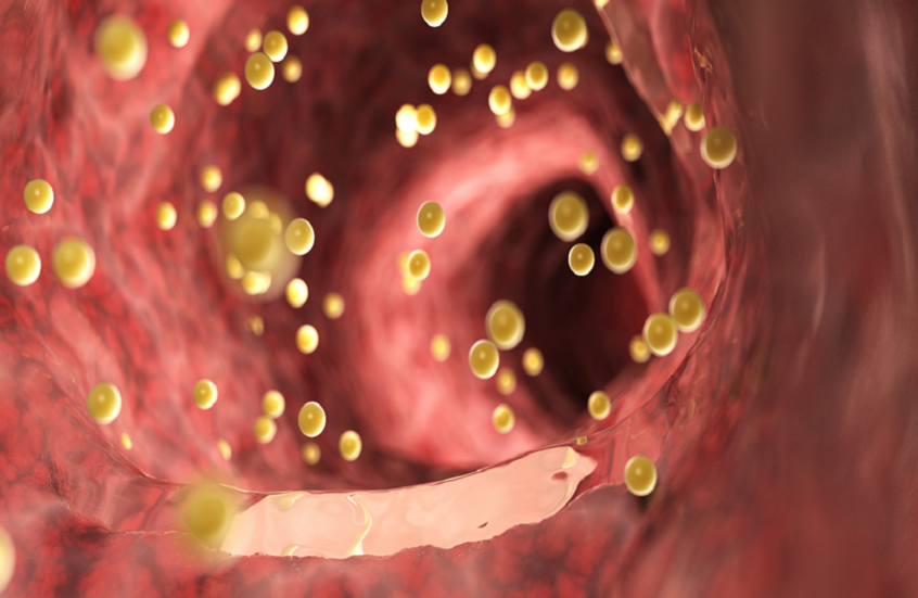 أمل جديد لمنع حساسية الطعام.. آلية وقائية واعدة!