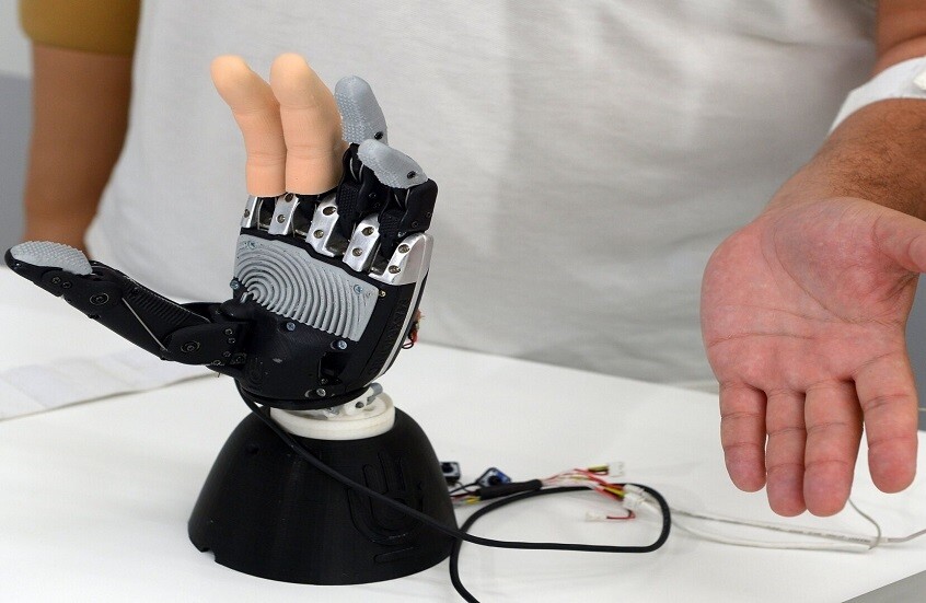 روسيا..ابتكار أطراف اصطناعية تُطبع على طابعة ثلاثية الأبعاد