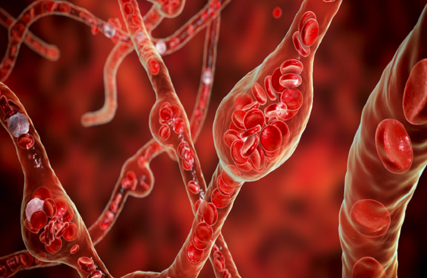 هل تخفّض تقنيات الاسترخاء ضغط الدم؟.. مراجعة علمية تحسم الجدل