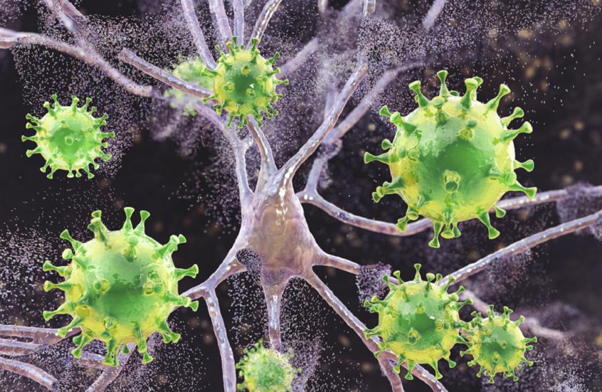 "كوفيد الطويل الأمد" والخرف المبكر.. تحذيرات من علاقة محتملة مثيرة للقلق!