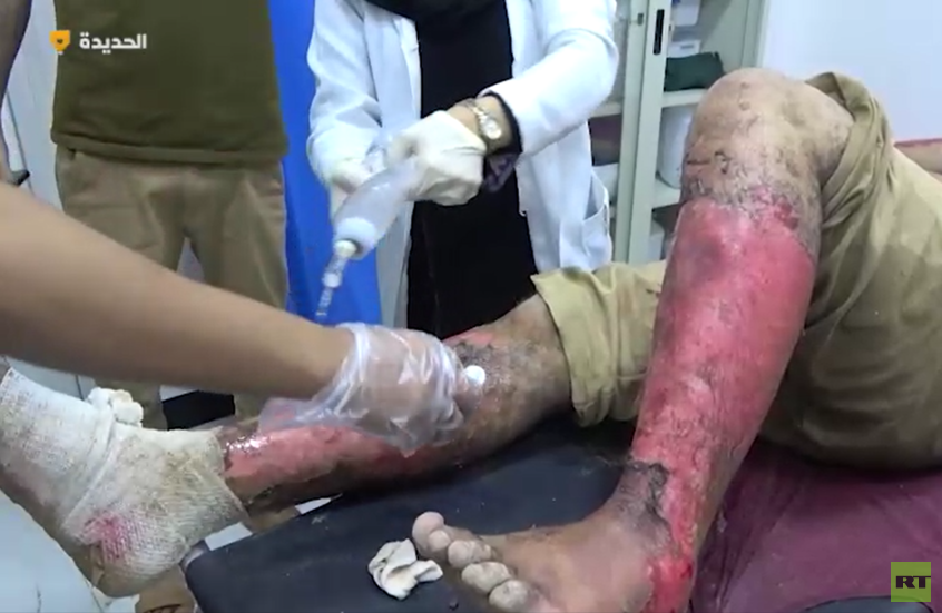 ارتفاع حصيلة ضحايا الغارات الأمريكية على منشأة رأس عيسى النفطية في اليمن