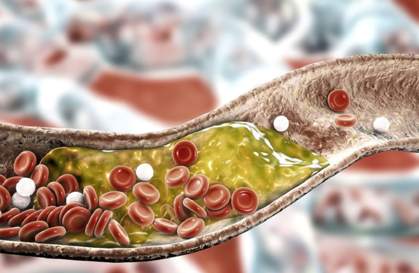 أطعمة ضرورية لخفض الكوليسترول والحفاظ على صحة القلب