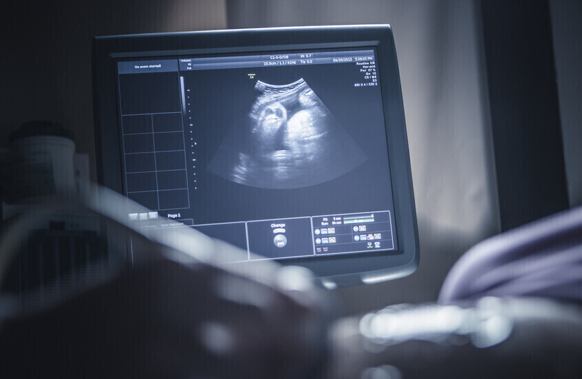 تحذير علمي.. مواد كيميائية في المنتجات المنزلية قد تعيق نمو دماغ الجنين