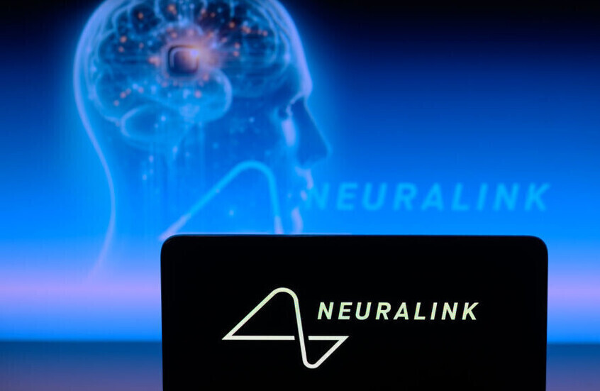 شريحة Neuralink تمنح مريضا مصابا بالتصلب الجانبي الضموري إمكانية التواصل مع الآخرين