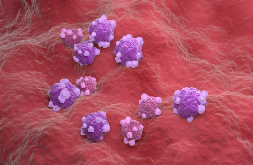 سلاح جديد لمحاربة أورام المبيض القاتلة