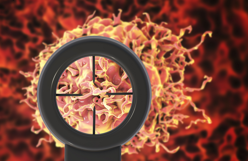 اختبار جديد يحقق تقدما كبيرا في تشخيص سرطان البروستات