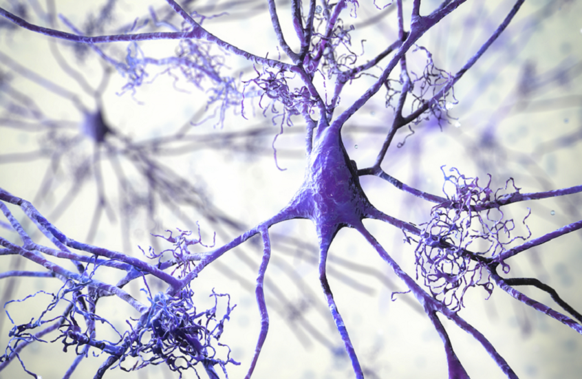 أمل جديد في علاج ألزهايمر.. اكتشاف إنزيم جديد يساهم في التدهور المعرفي