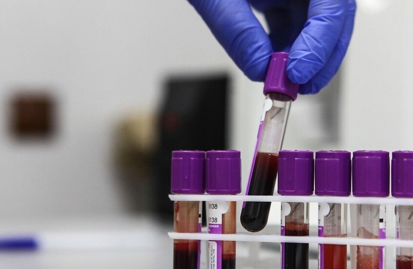 أسباب الأورام القاتلة والوقاية منها