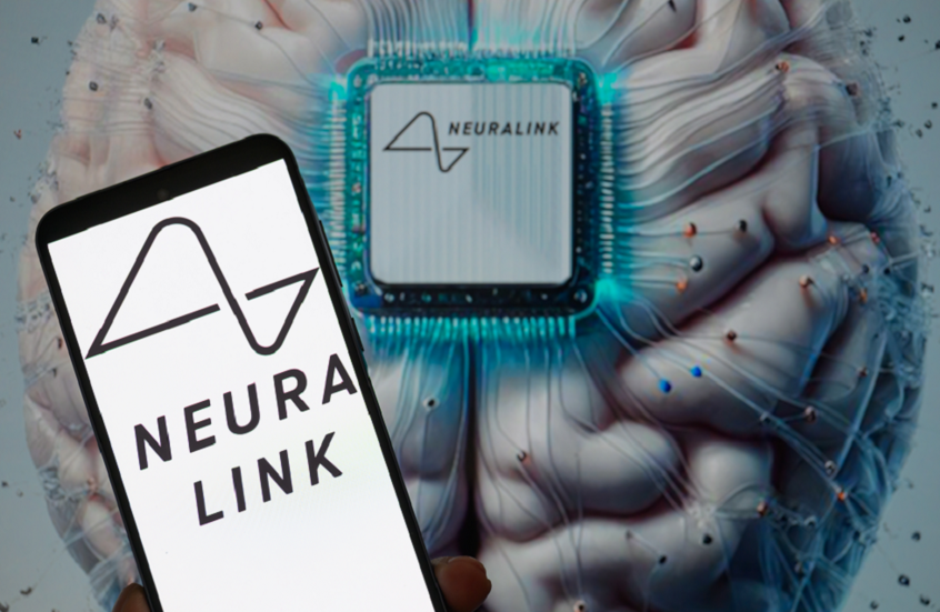 إنجاز جديد لـNeuralink.. مريض يحرر فيديو باستخدام إشارات دماغه