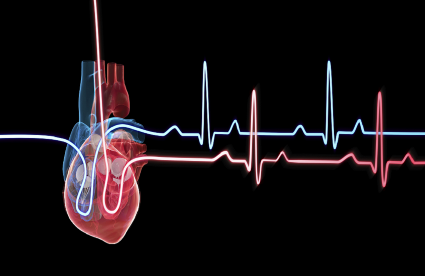 اكتشاف آلية غير متوقعة وراء تلف القلب بعد النوبات