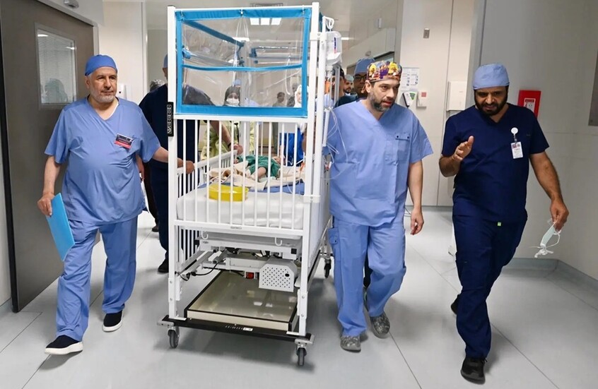 السعودية.. انتهاء عملية فصل توأم طفيلي مصري بنجاح في وقت قياسي (صور)