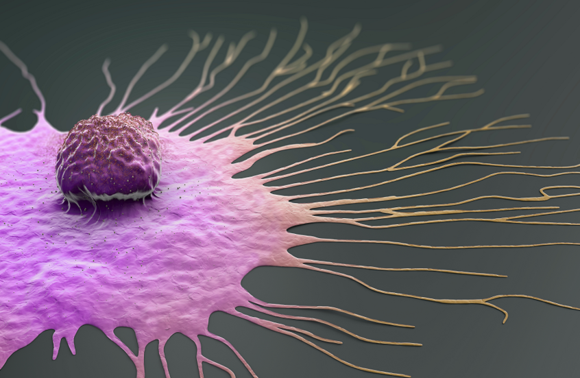 الوزن وسن الإنجاب.. عوامل متداخلة تؤثر في خطر سرطان الثدي