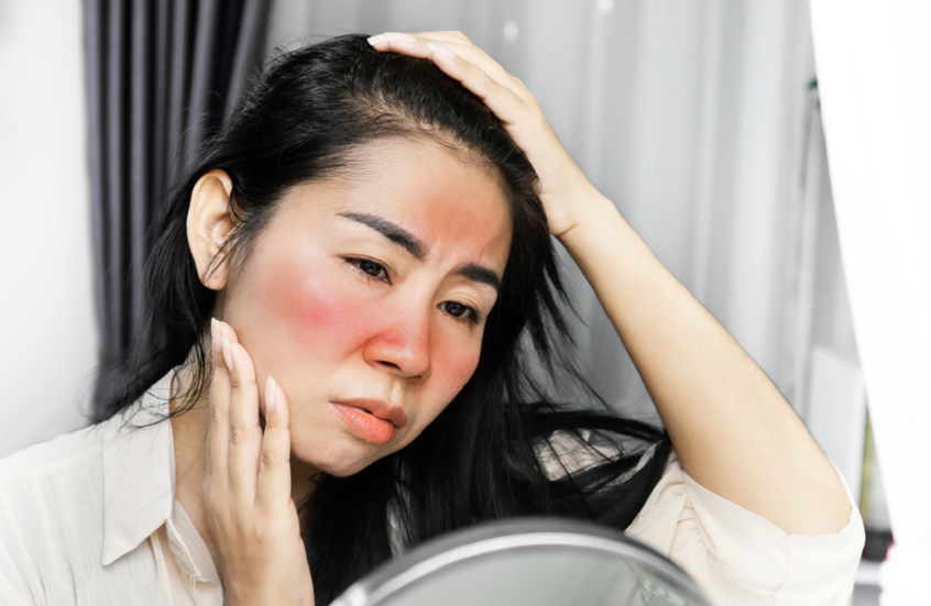 أدوية شائعة قد تجعل بشرتك أكثر عرضة لحروق الشمس الشديدة