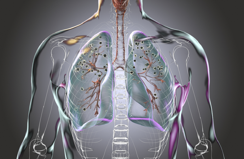 في أي عمر تبلغ سعة الرئة ذروتها؟.. دراسة جدلية تقدم الإجابة