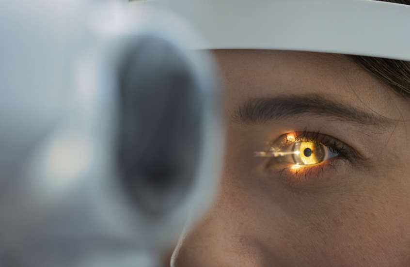 مكملات فيتامين هام قد تُبطئ تطور "المياه الزرقاء"