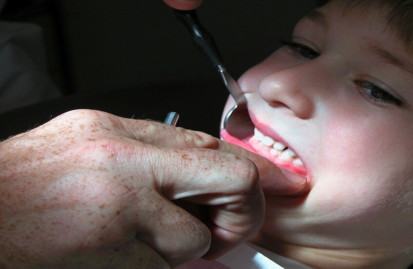 أمراض يسببها التهاب اللثة