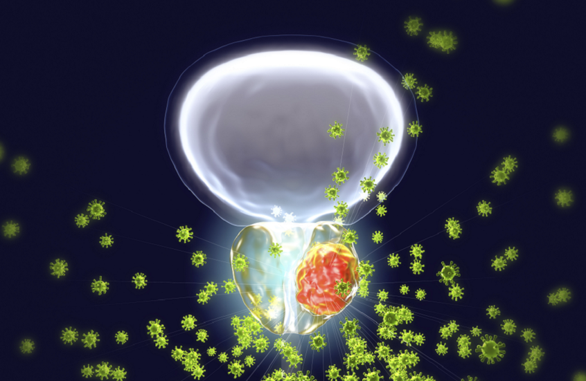 تمارين رياضية قد تحد من خطر الإصابة بسرطان البروستات