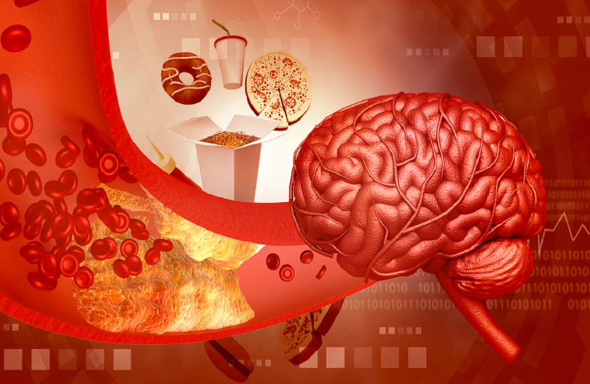 العلاقة المعقدة بين التغذية الحديثة والأمراض العصبية
