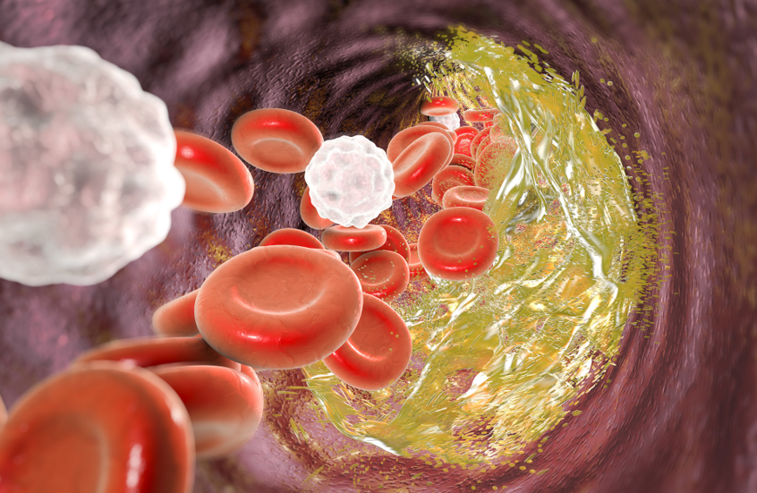 فاكهة لذيذة تحارب الكوليسترول الضار وتدعم صحة القلب