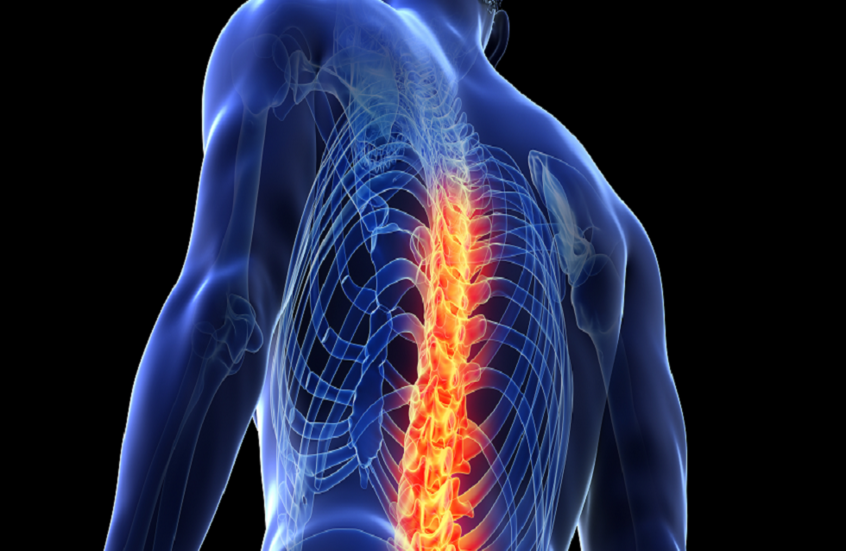 تقنية مبتكرة تبشّر بآفاق لعلاج إصابات النخاع الشوكي