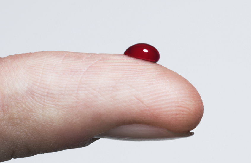 تغيرات جلدية قد تكشف إصابتك الوشيكة بالسكري