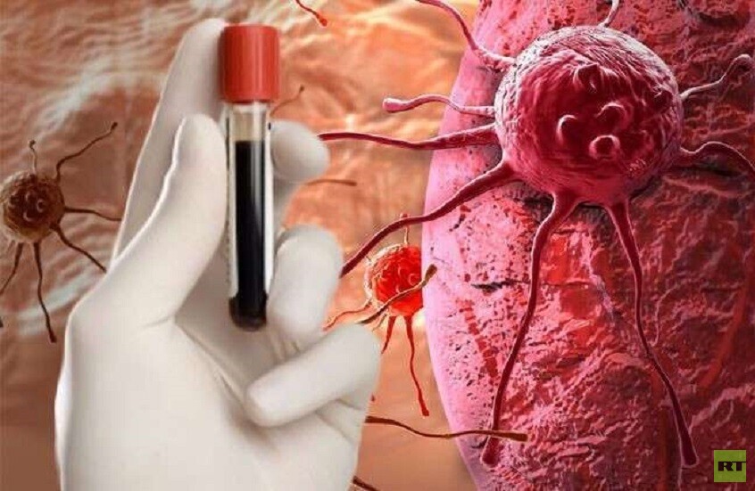 علامات غير واضحة للسرطان