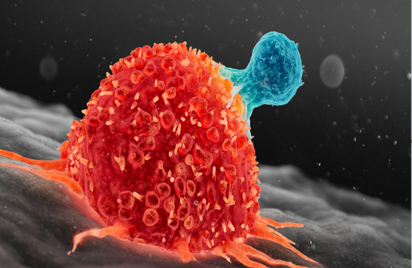 دواء واعد يبطئ نمو سرطان الثدي ويؤجل الحاجة للعلاج الكيميائي