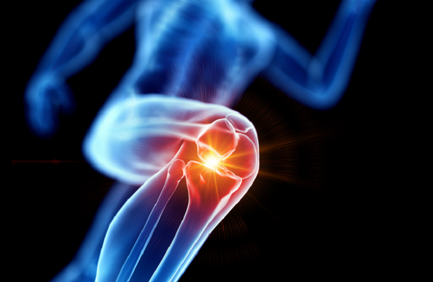 5 حلول فعالة لتخفيف طقطقة الركبة