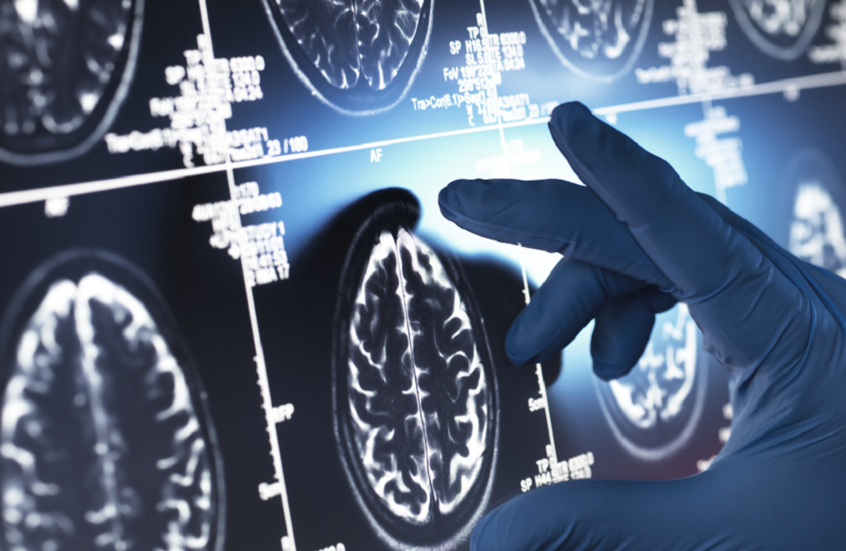 الفضول المعرفي.. ودوره في درء خطر التدهور العقلي