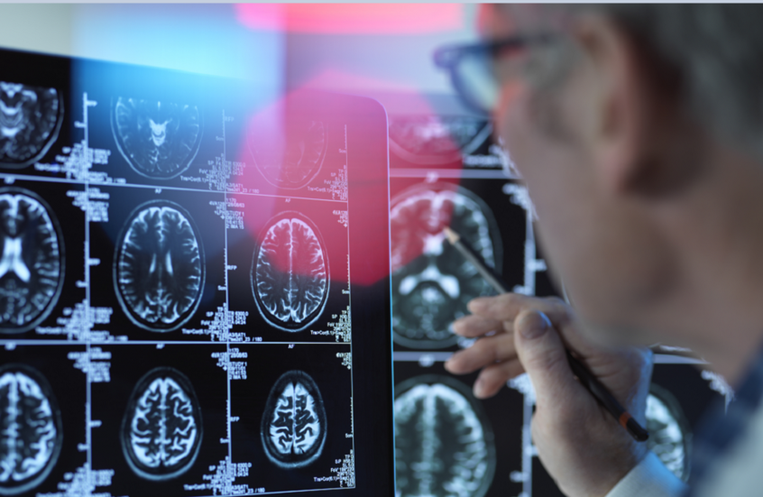 اكتشاف مفتاح محتمل للوقاية من الخرف قبل سن الثمانين