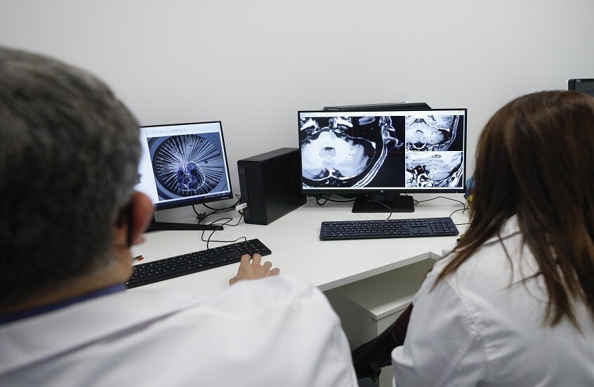 أعراض غير واضحة لورم الدماغ