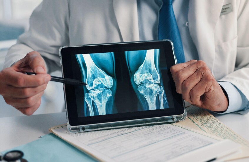 أغذية تحمينا من كسور العظام عند الشيخوخة