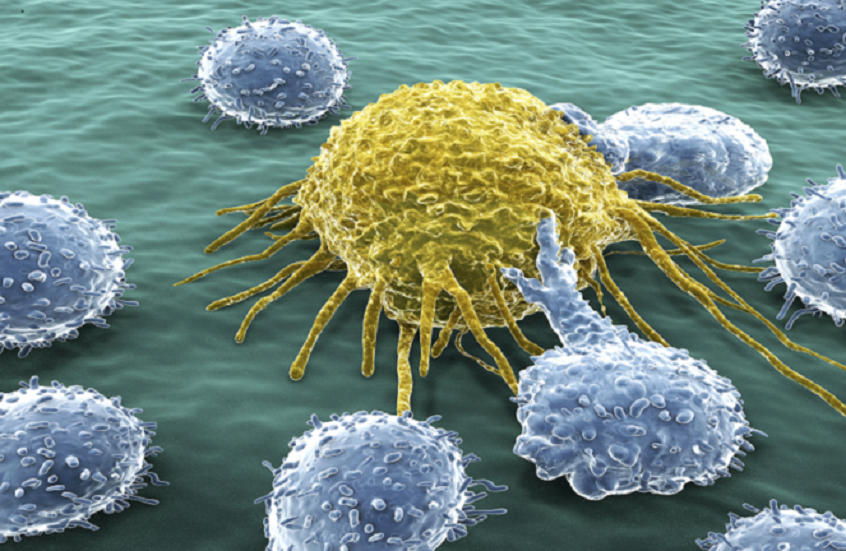 اكتشاف سبب سرعة انتشار السرطان لدى بعض المرضى