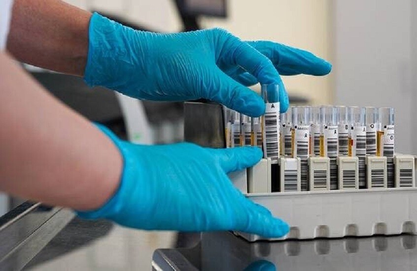 روسيا.. بدء اختبارات سريرية للقاحات جديدة ضد السرطان
