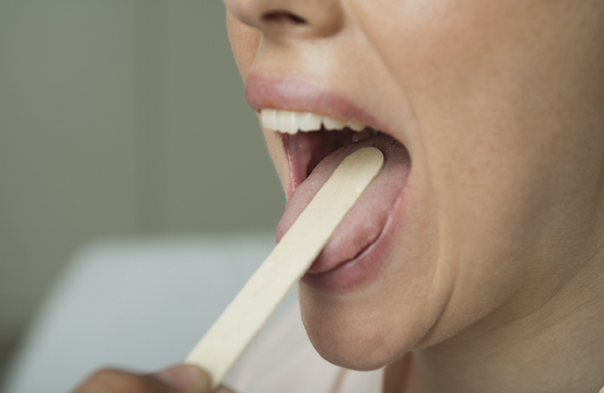 علميا.. ماذا يخبرنا اللسان عن صحتنا؟