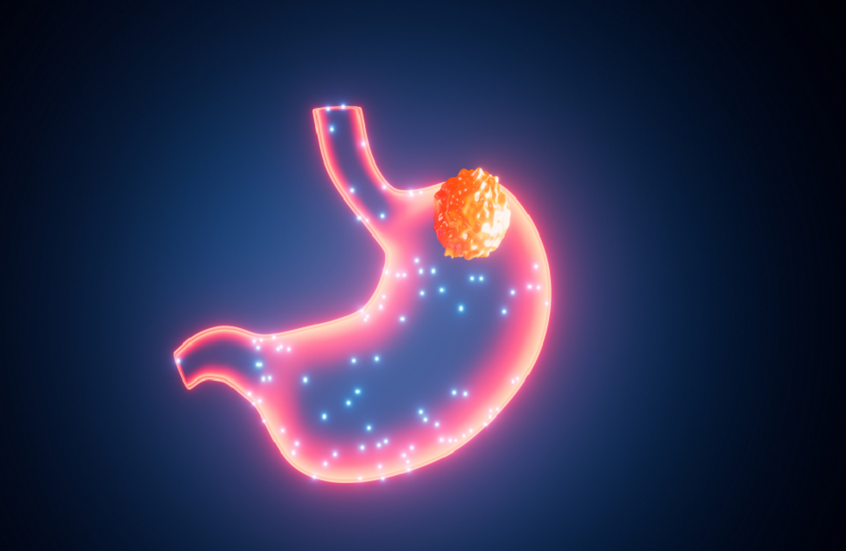 إنجاز طبي رائد.. "علي بابا" تطلق "أول ذكاء اصطناعي عالمي" لكشف سرطان المعدة مبكرا