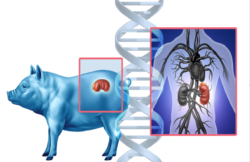 اختراق طبي في مجال زراعة كلى الخنازير لدى البشر بأمان
