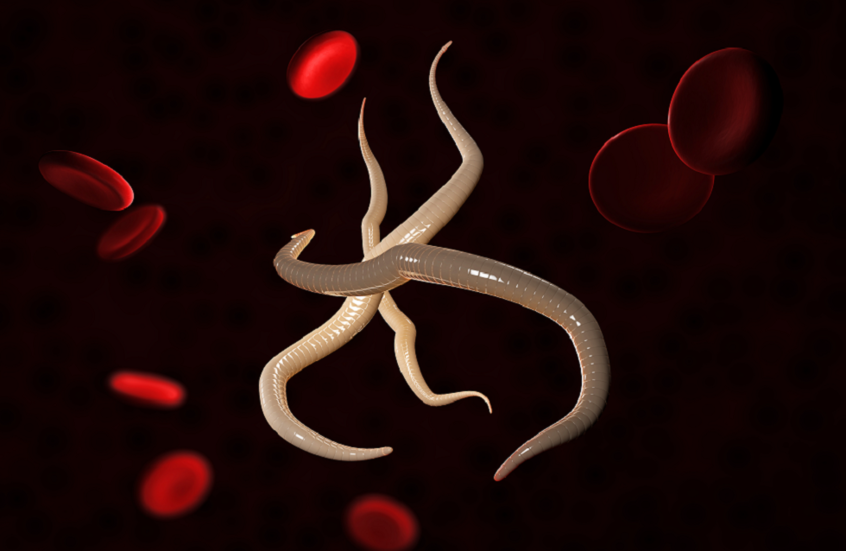 مأساة طبية.. ديدان طفيلية تغزو جسدي مريضين إثر زرع كلى ملوثة في أمريكا