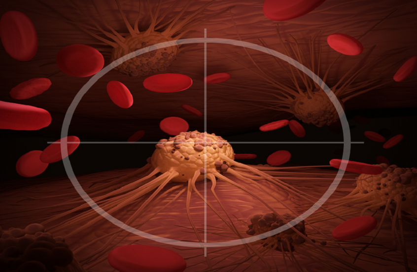 اكتشاف سبب جديد لسرطان عدواني يصيب الشابات