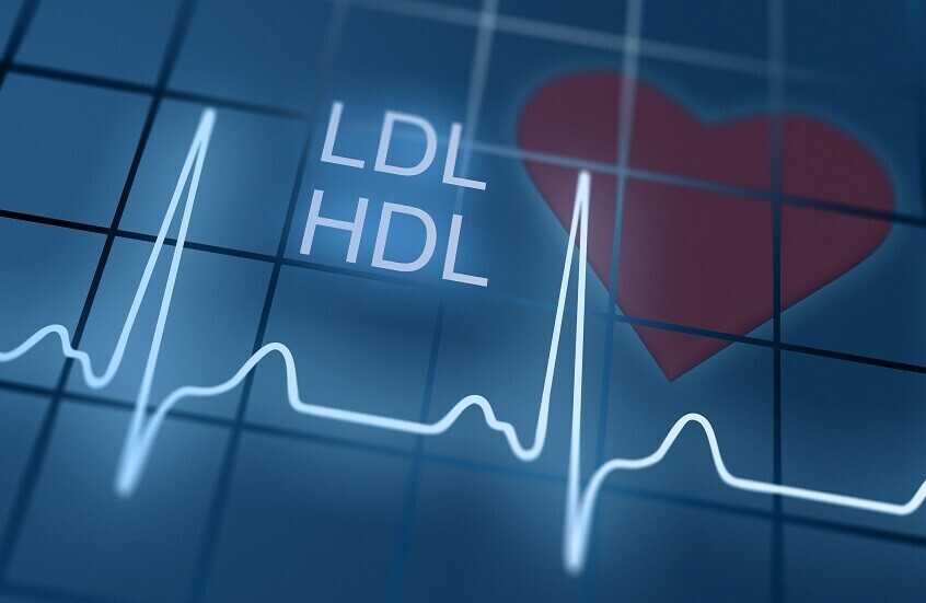 طبيب روسي: أمراض خطيرة قد تتطور حتى مع مستويات طبيعية من الكوليسترول في الدم