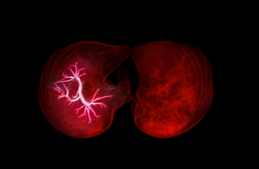 في إنجاز غير مسبوق.. إنشاء رئات مصغّرة مزودة بأوعية دموية كاملة