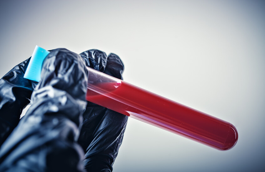 دراسة: "مواد كيميائية أبدية" في دماء جميع سكان هولندا تتجاوز الحدود الآمنة