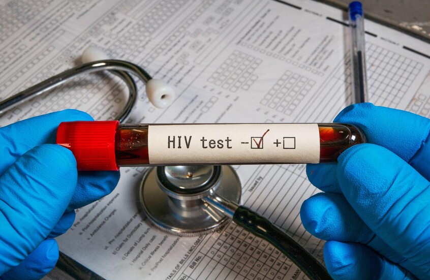 أوزبكستان تلزم فئة من العائدين من الخارج بفحص فيروس نقص المناعة البشرية