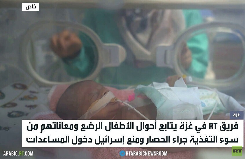 أطفال غزة.. سوء التغذية والموت جوعا